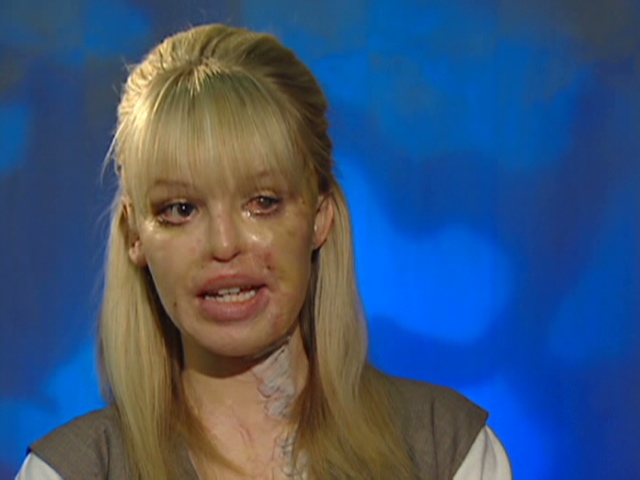 London England CNN Katie Piper had everything going for her a 